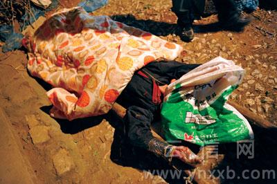 六旬老汉狂犬病发作打死妻子 次日因病死亡(图)--中国年鉴网
